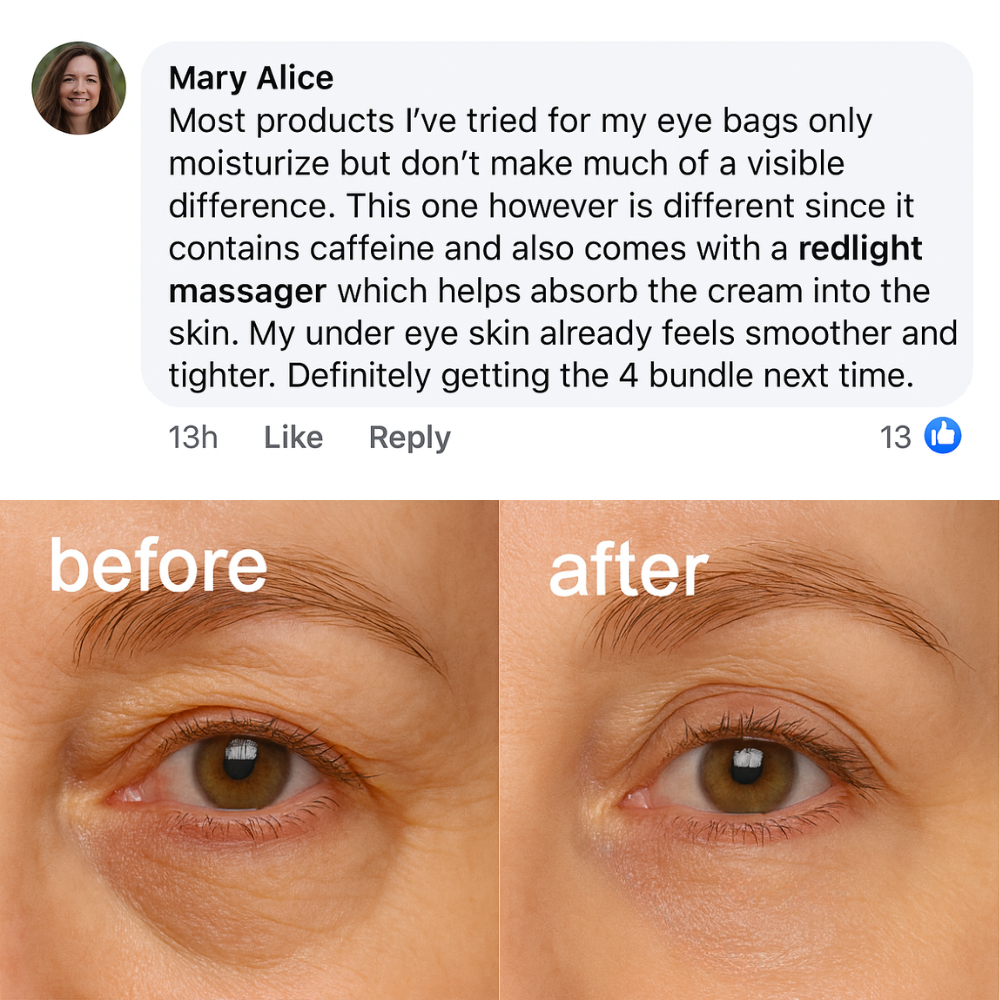 PEAQ™ Dark Circles & Eye Bag Cream